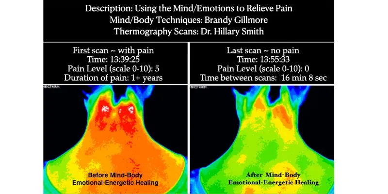 thermography image showing healing results