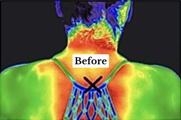 pain and inflammation before